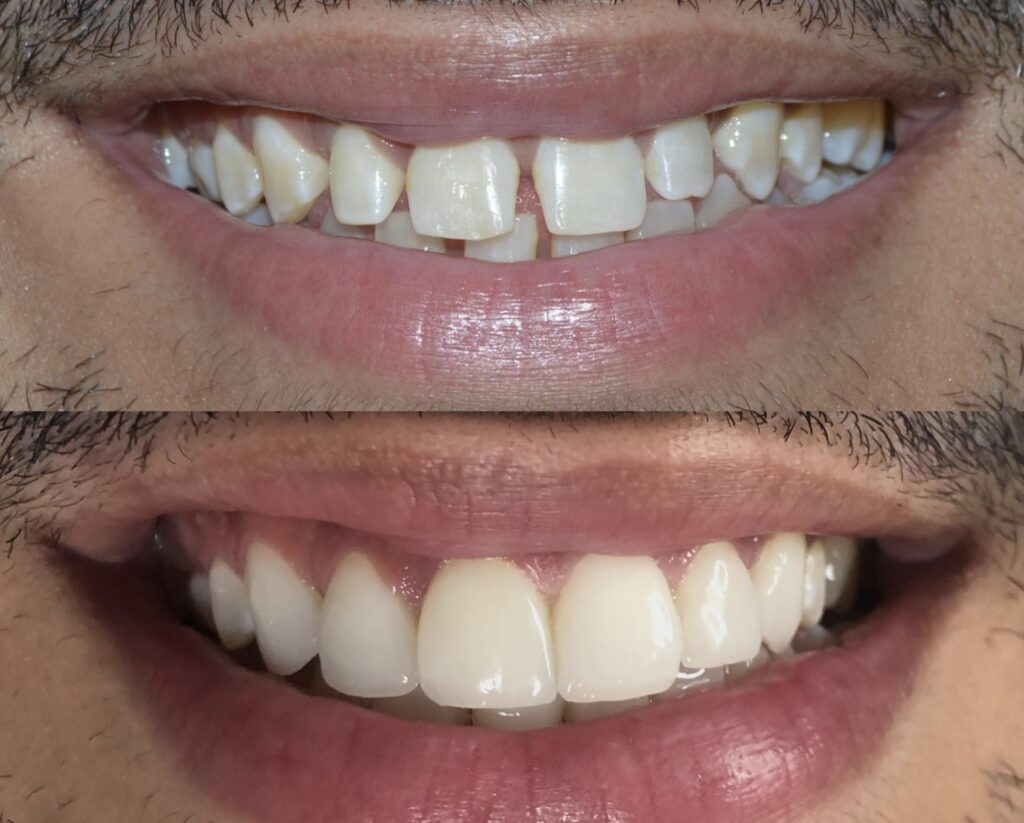 Caso clínico odontológico antes e depois